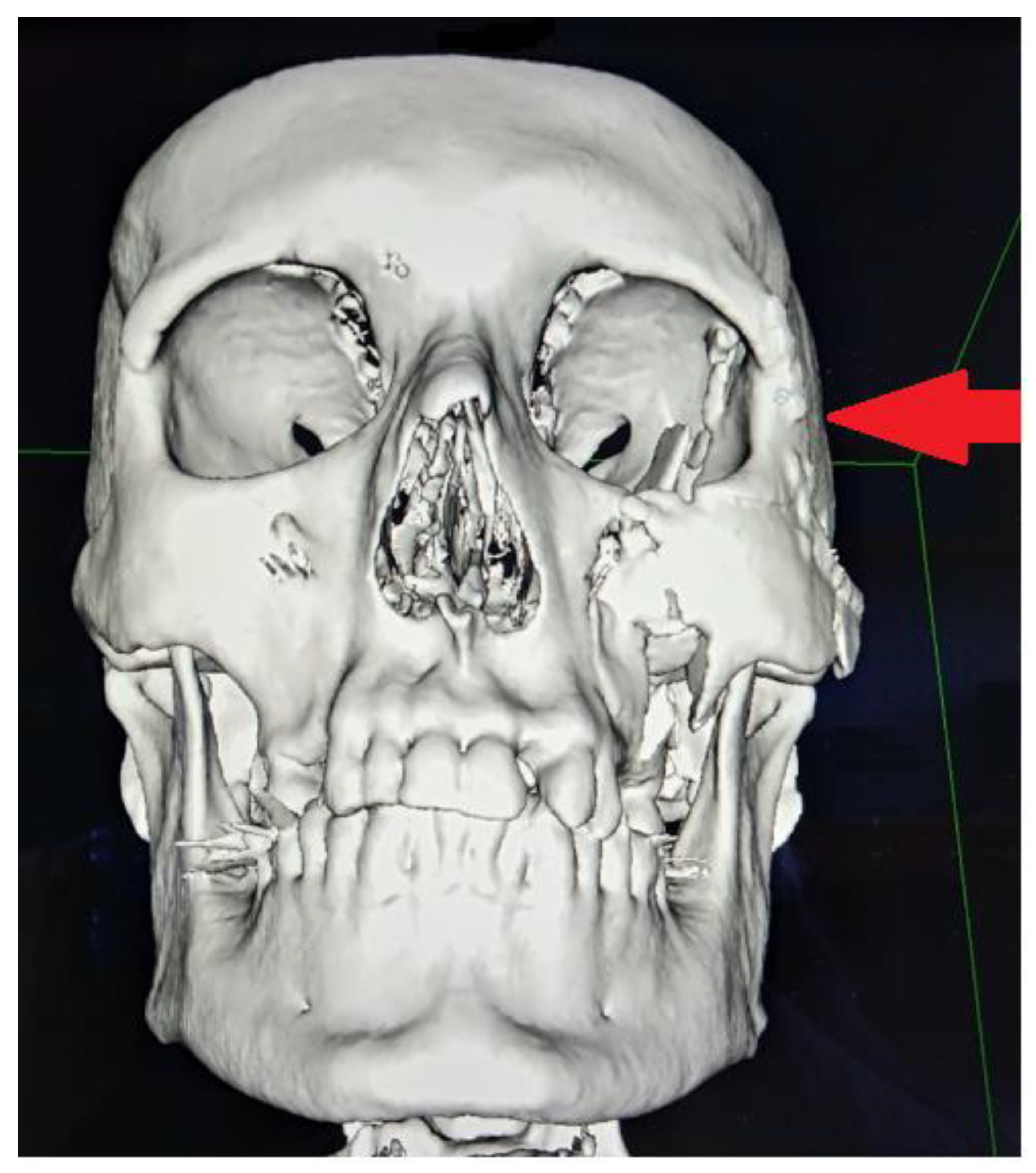 Applsci 13 03611 g014