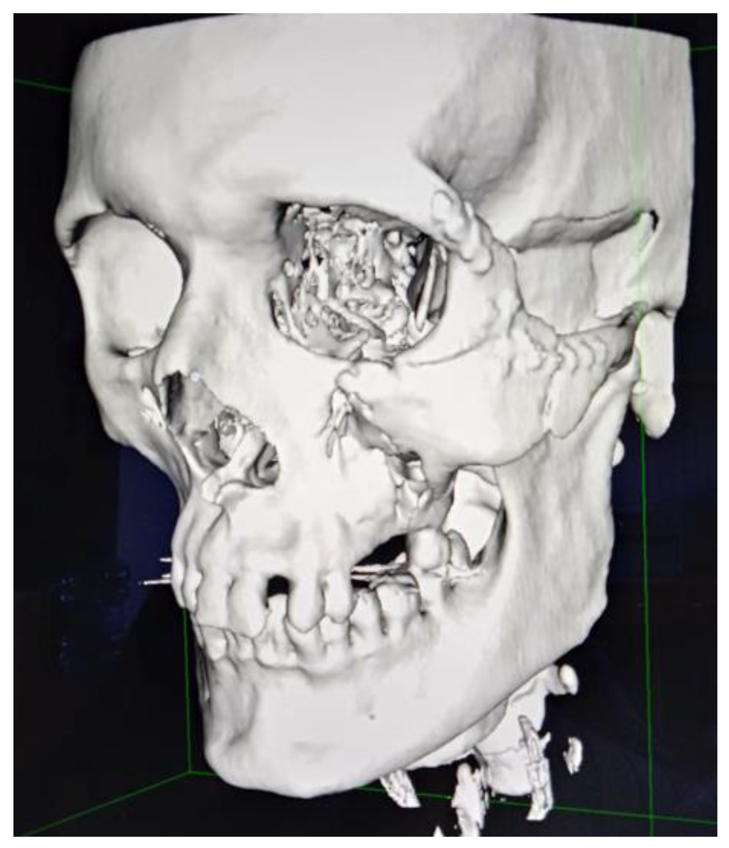 Applsci 13 03611 g015