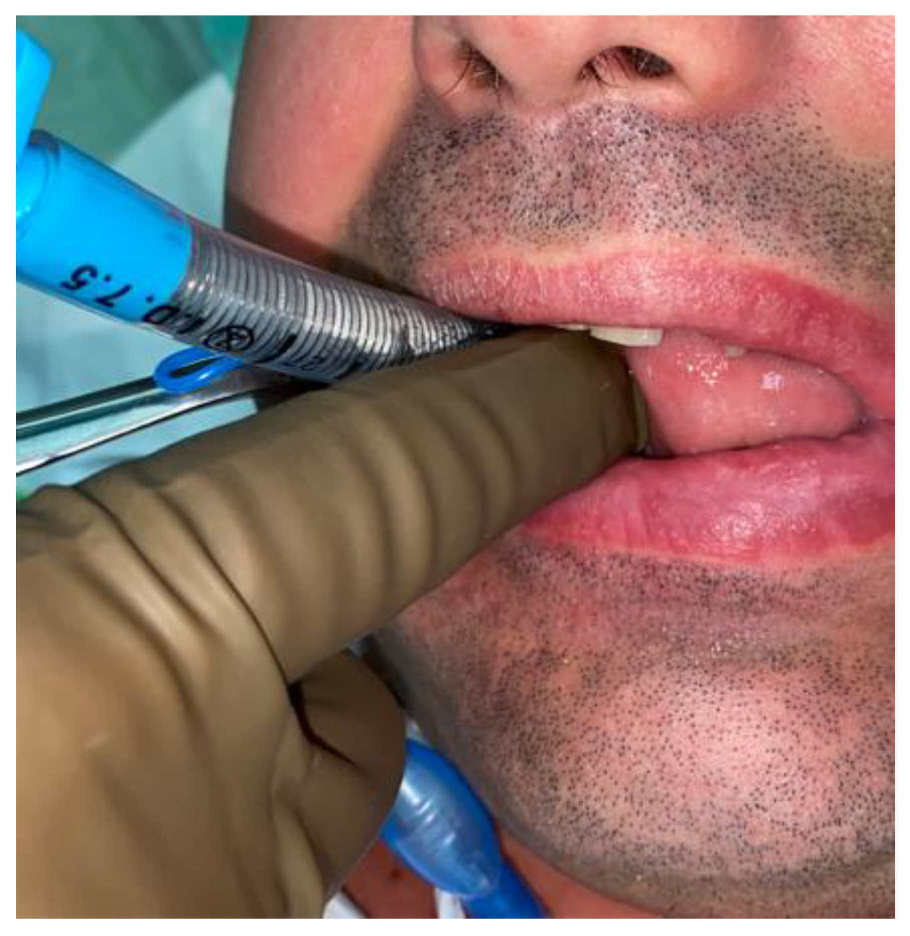 Applsci 13 03611 g017