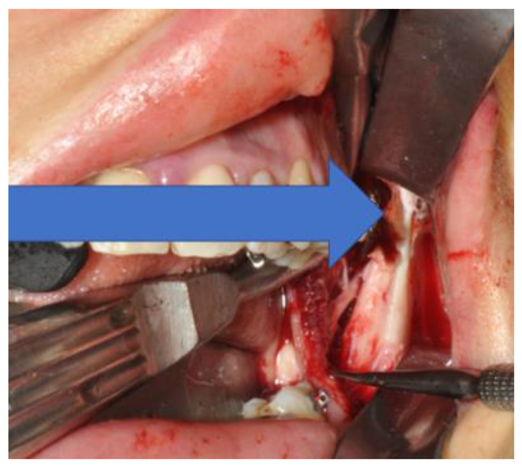 Applsci 13 03611 g018