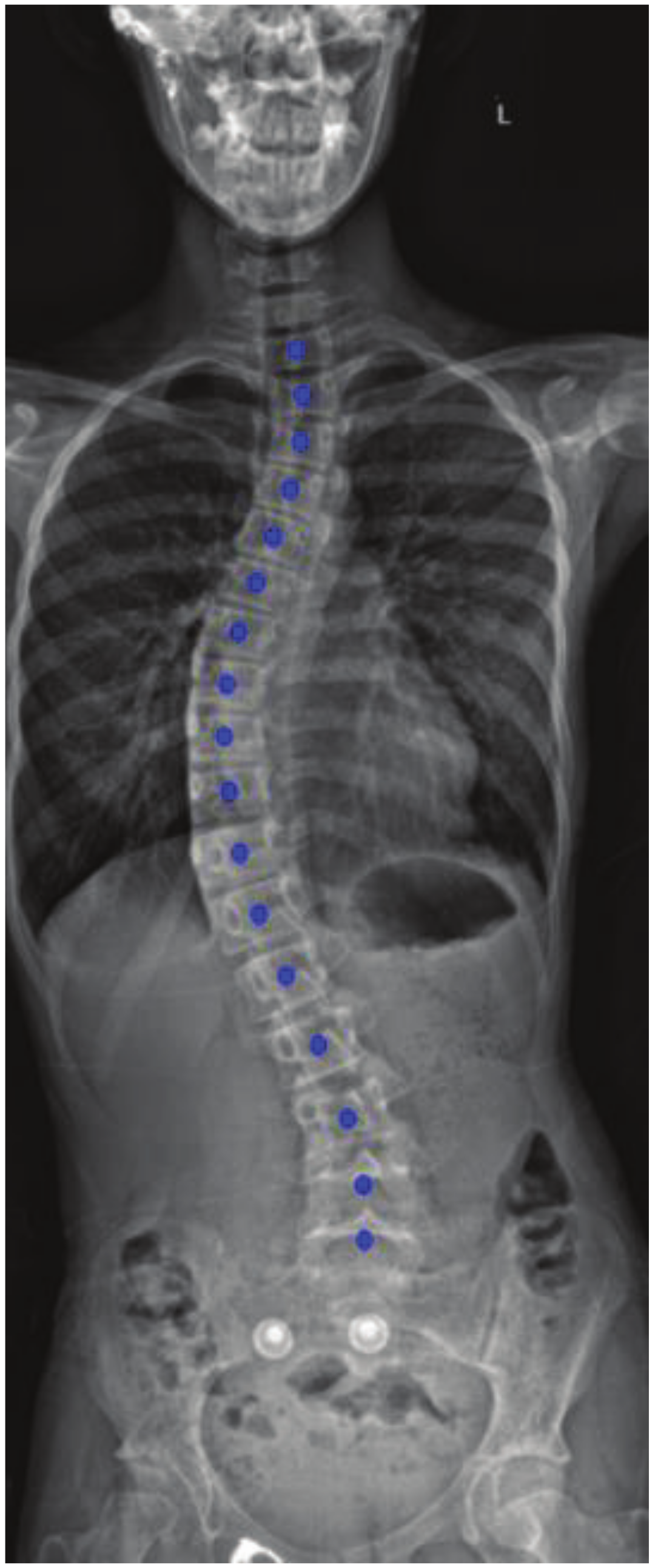 Applsci 13 03817 g006