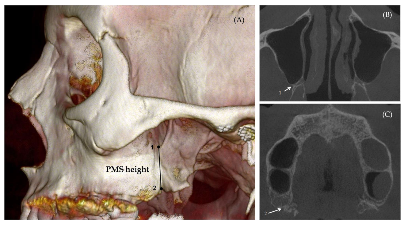 Applsci 13 03825 g004