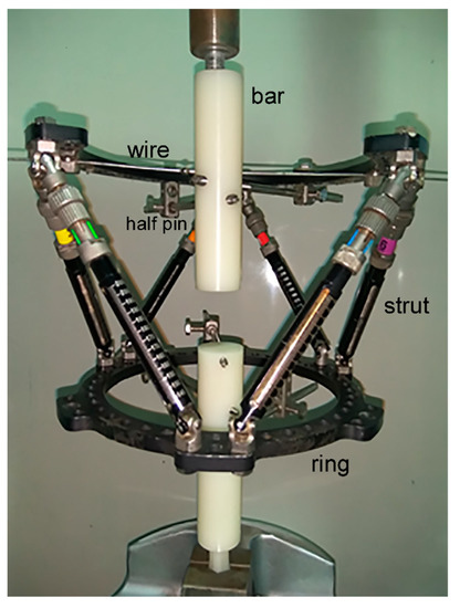 Taylor Spatial Frame Behavior in High Tibial Osteotomies: A