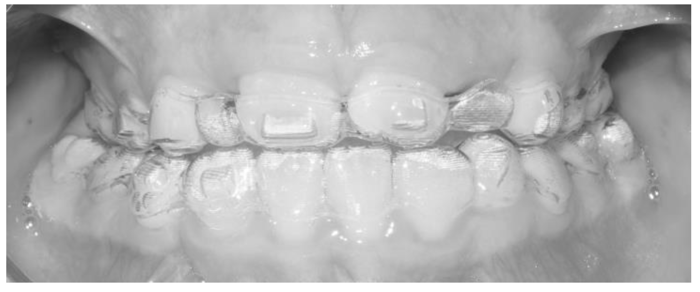 ※バラ売り不可裁断Journal of Aligner Orthodontics バラ売り不可裁断Journal of Aligner Orthodontics