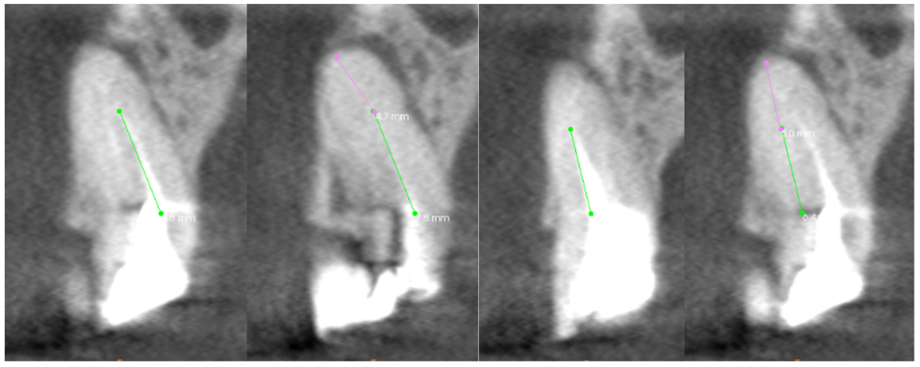 Applied Sciences Free FullText The Application of Mixed Reality in Root Canal Treatment