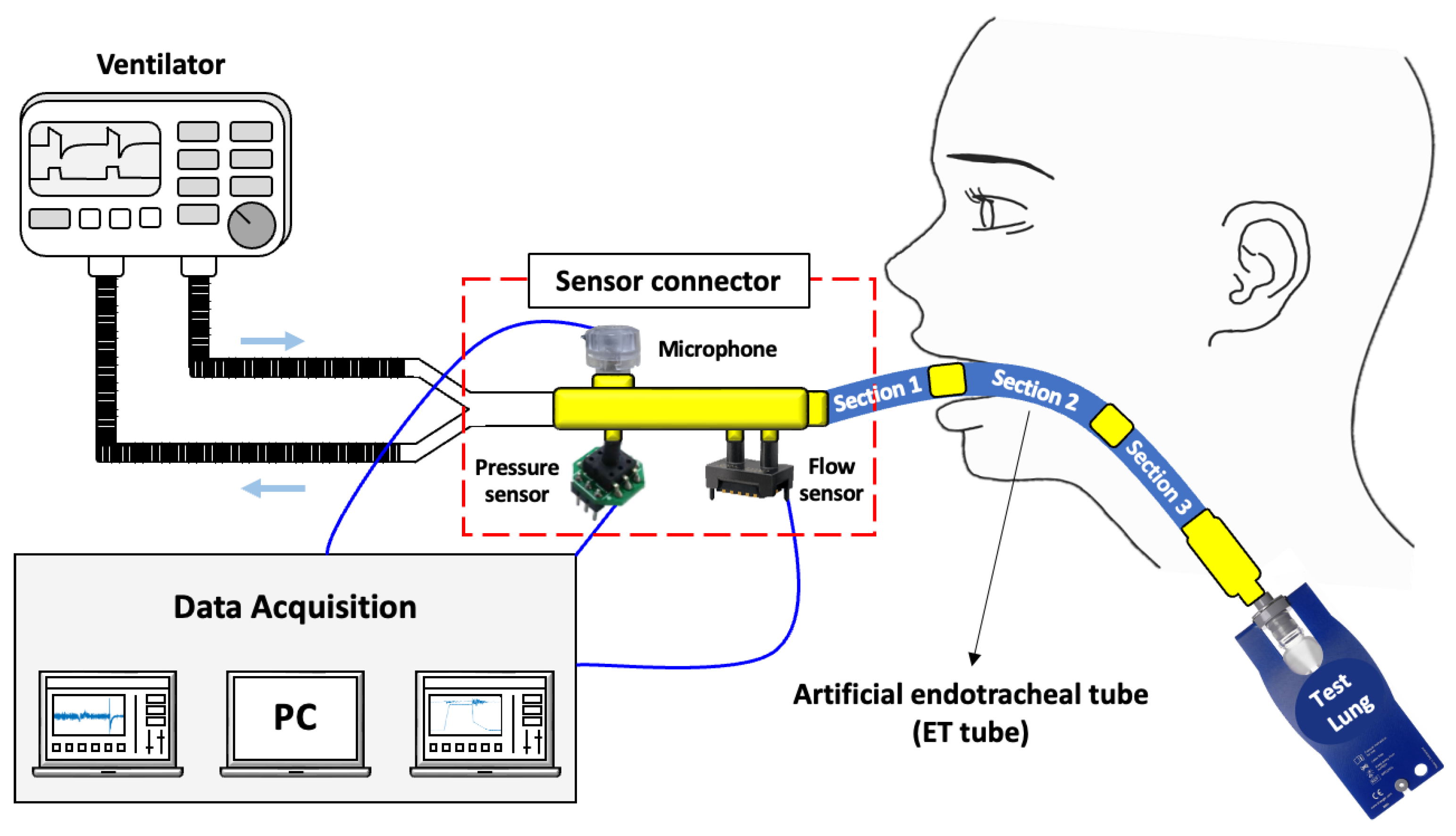 Endotracheal Tube endotracheal-tube