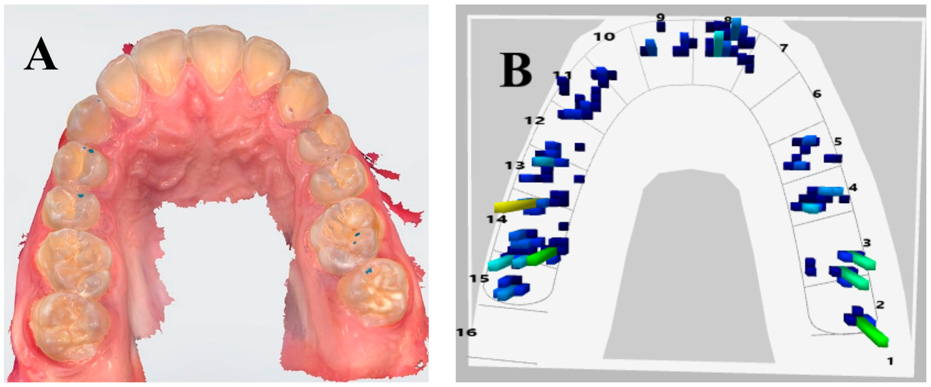 Applsci 13 04335 g003 Applsci 13 04335 g003