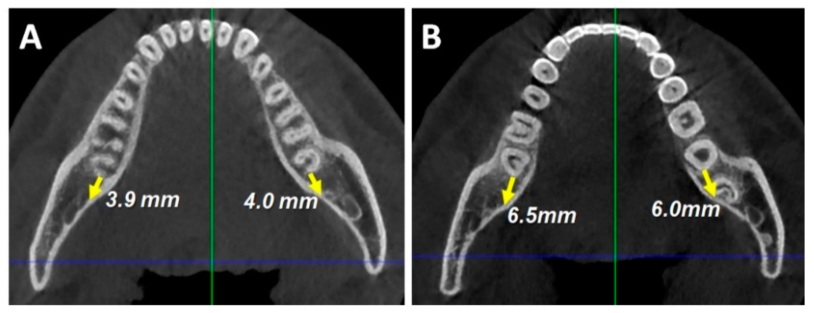 Applsci 13 04535 g005