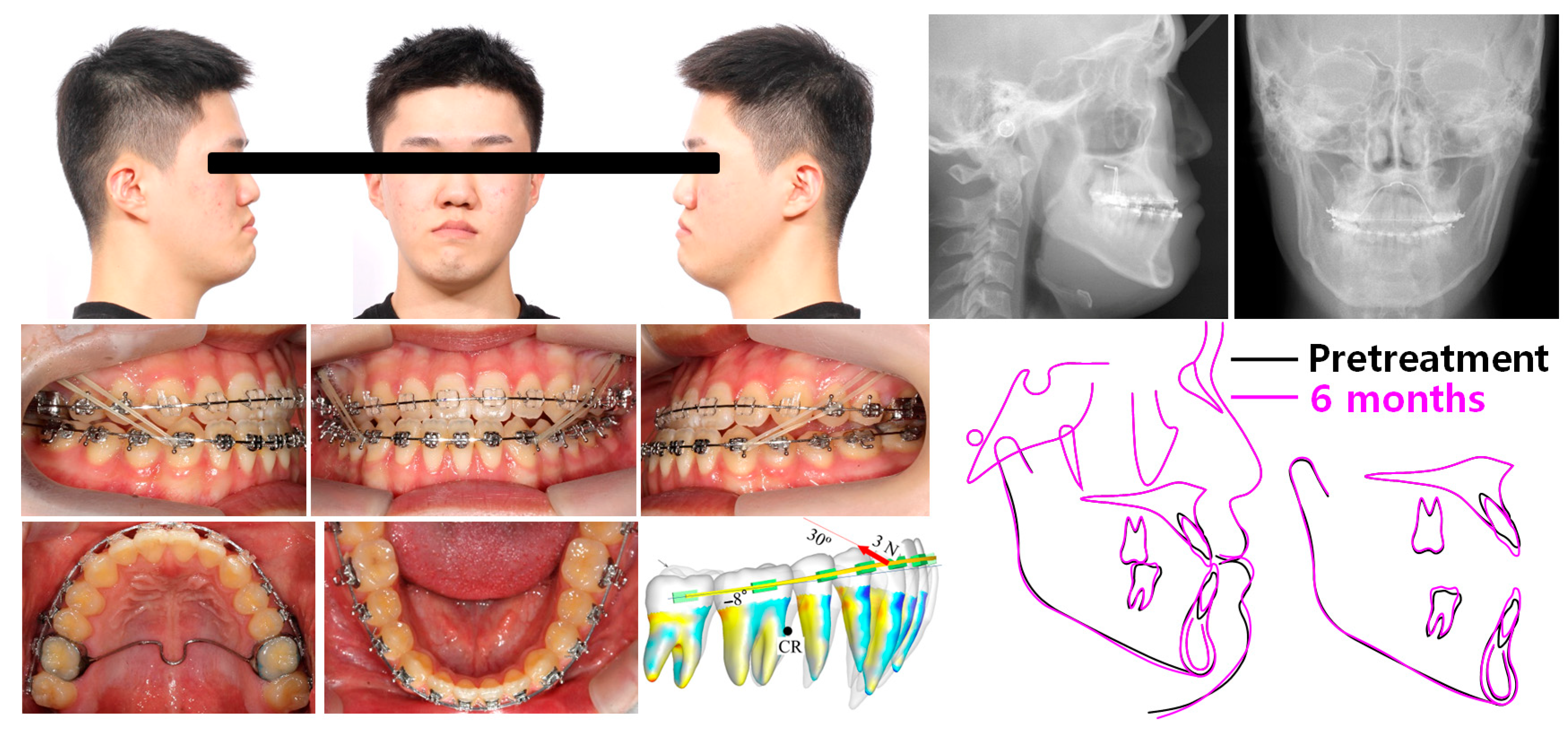 Applsci 13 04535 g006