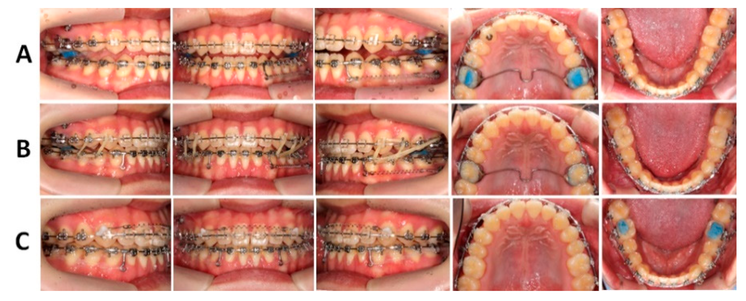 Applsci 13 04535 g007