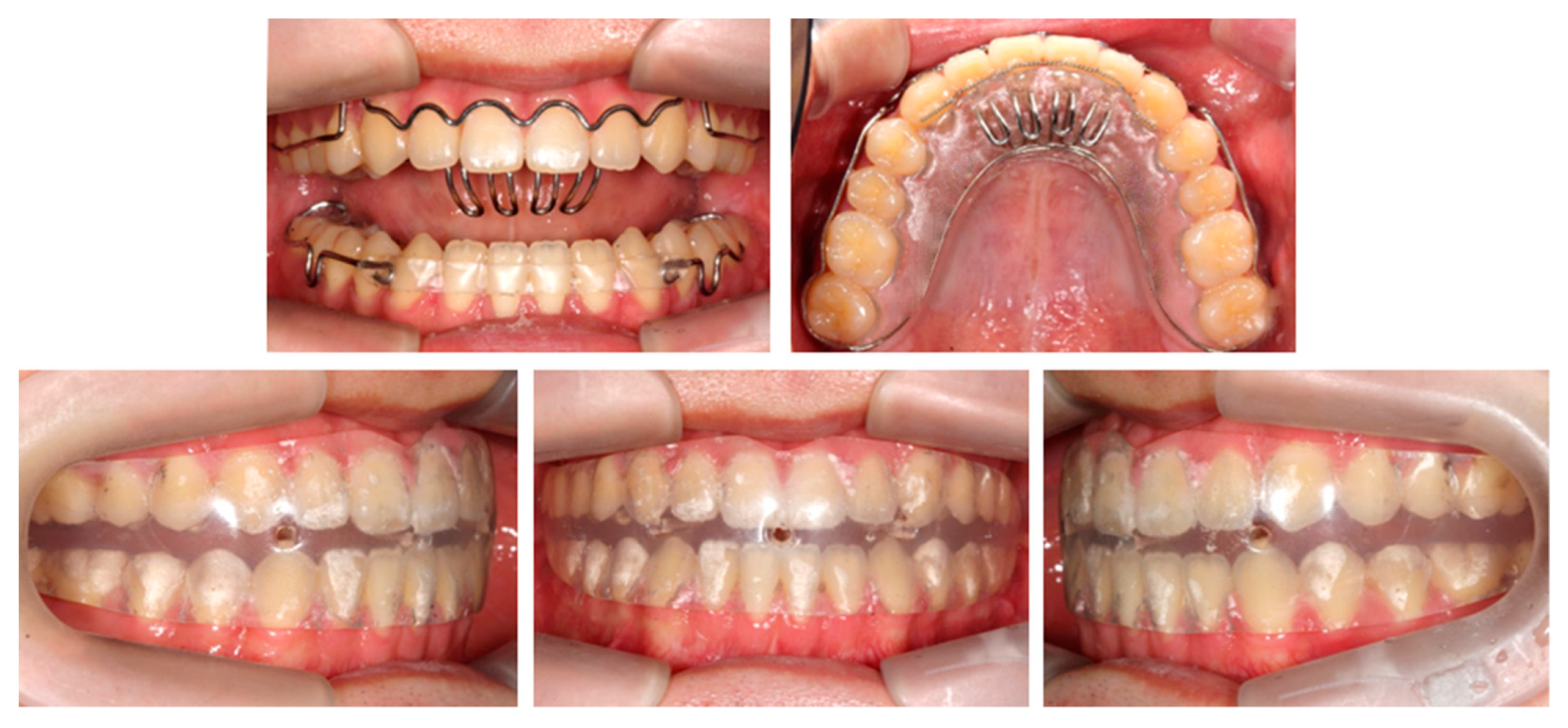 Applsci 13 04535 g008