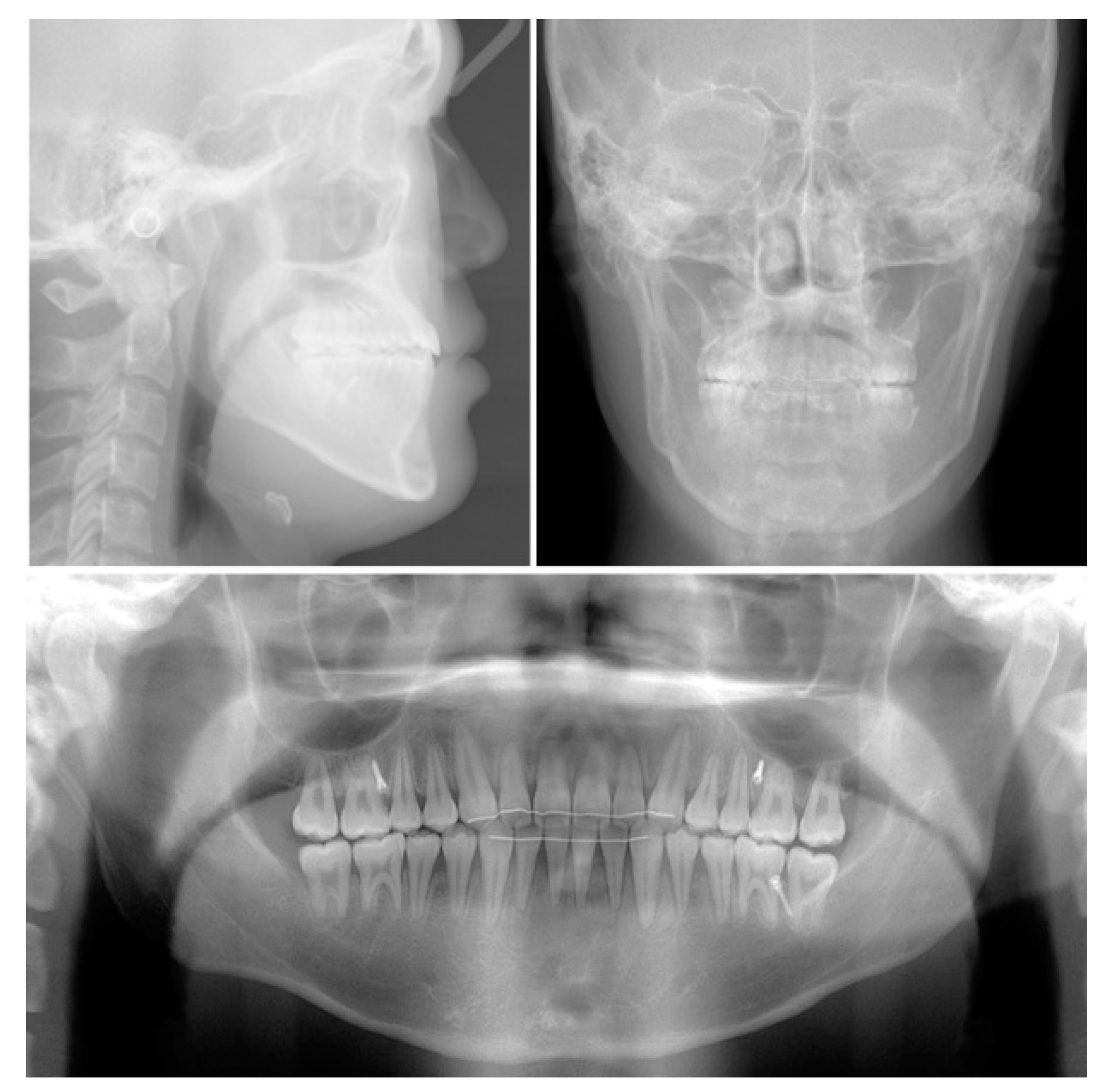 Applsci 13 04535 g011