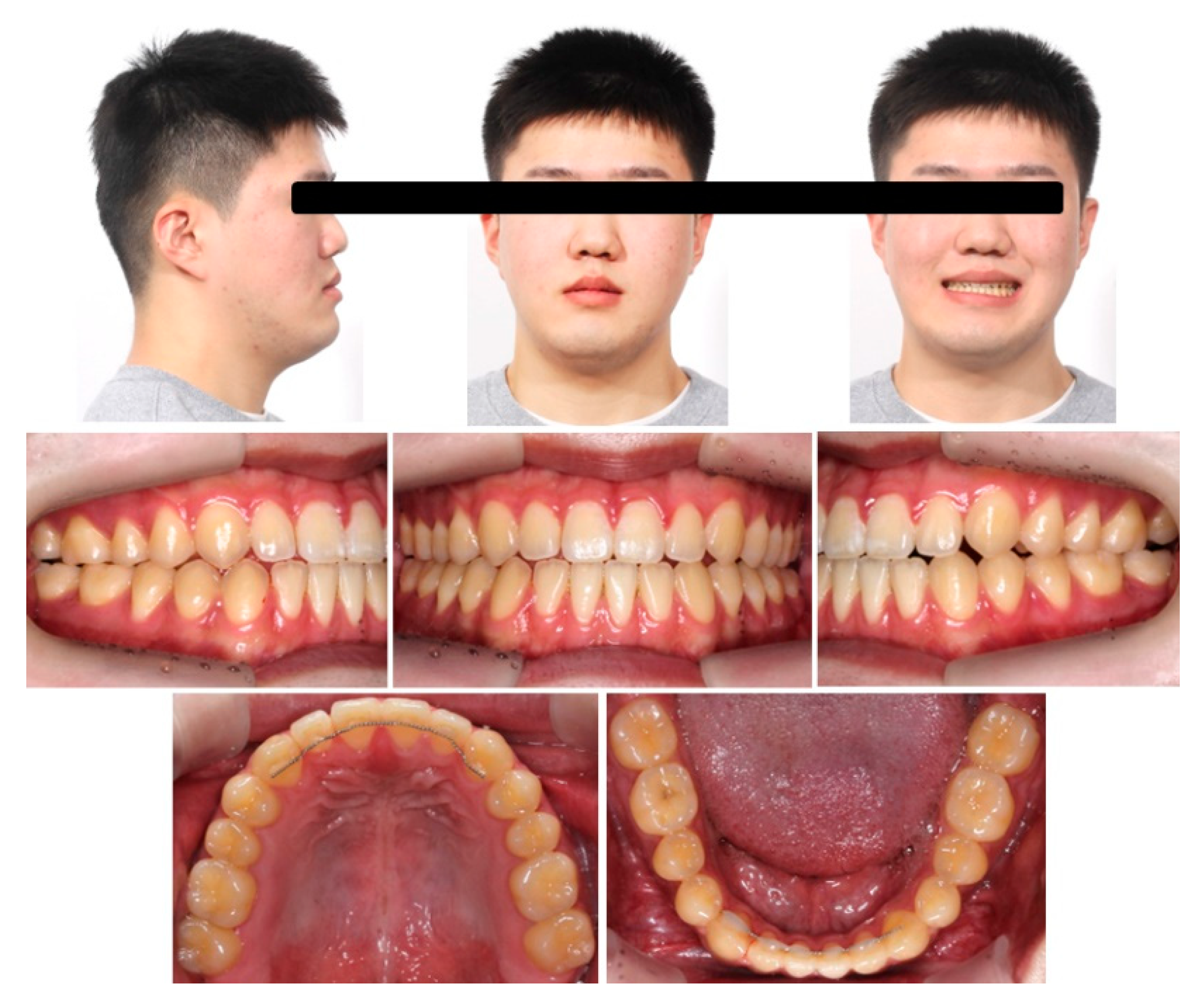 Zwfmockaitis Orthodontics 92 - uy5fr0o