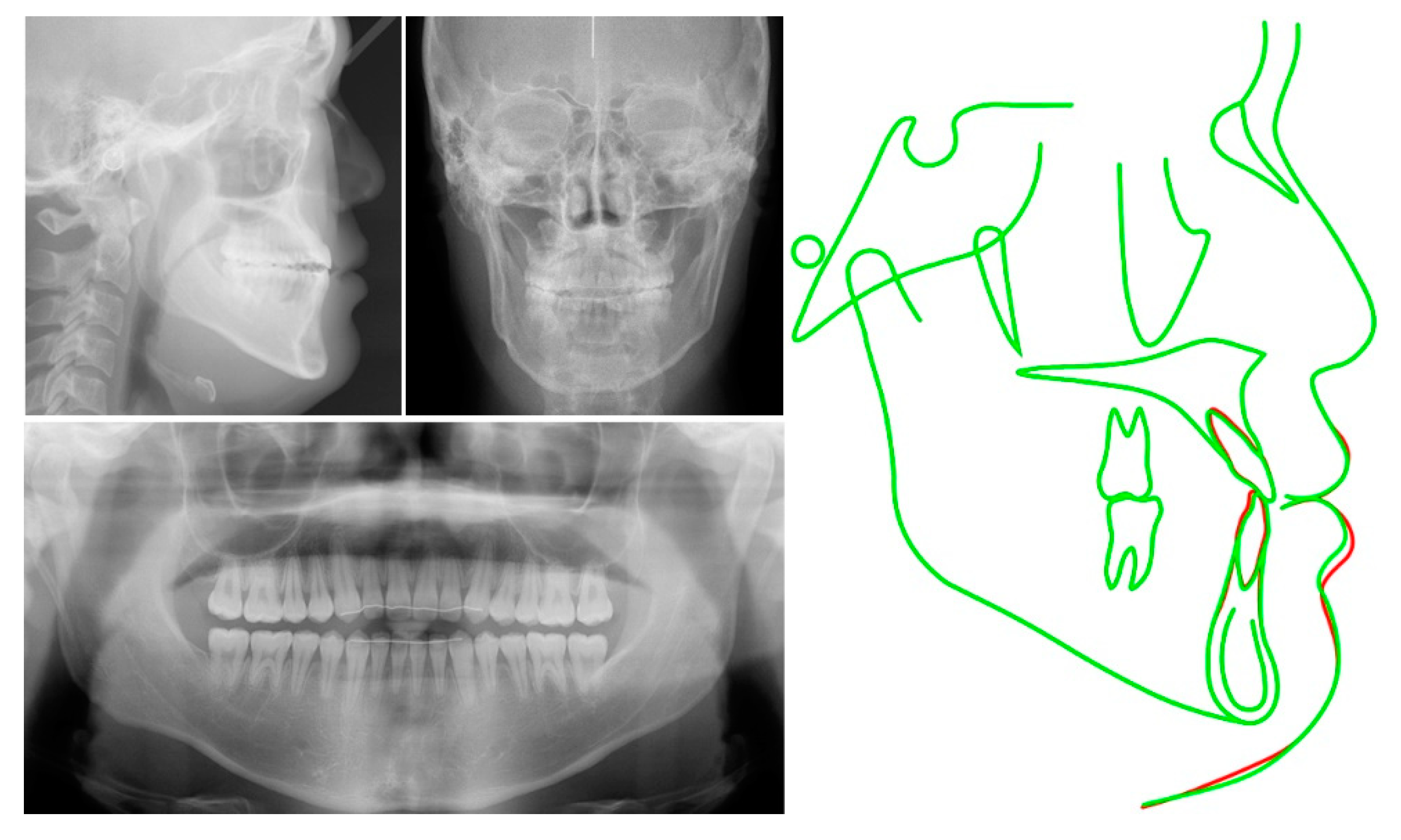 Applsci 13 04535 g015