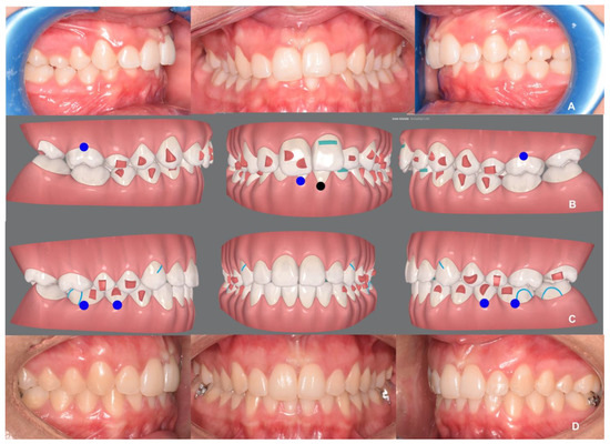From Reverse Engineering Software to CAD-CAM Systems: How Digital ...