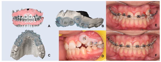 From Reverse Engineering Software to CAD-CAM Systems: How Digital ...