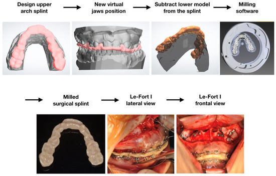 From Reverse Engineering Software to CAD-CAM Systems: How Digital ...