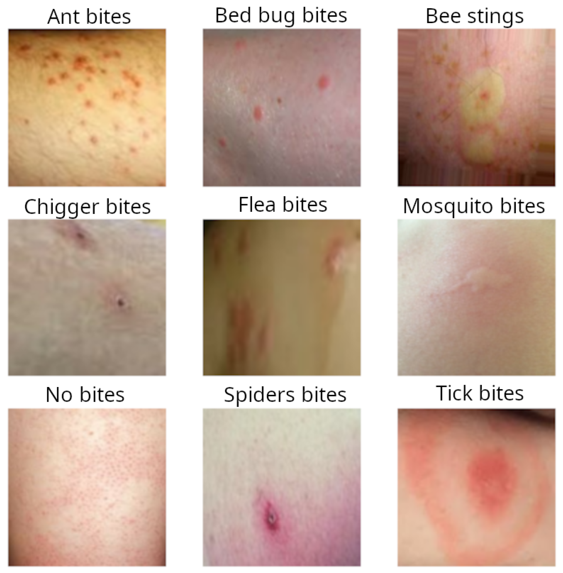 Identifying Bug Bites On Humans