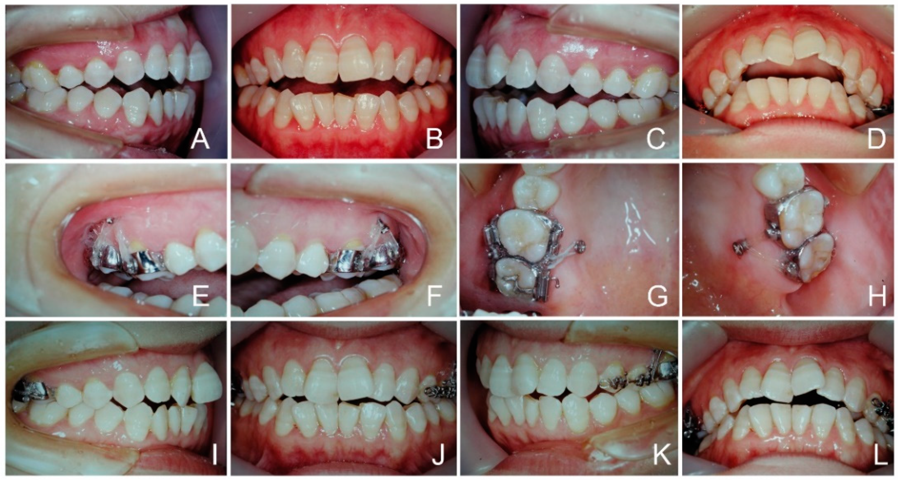 Applsci 13 05464 g001