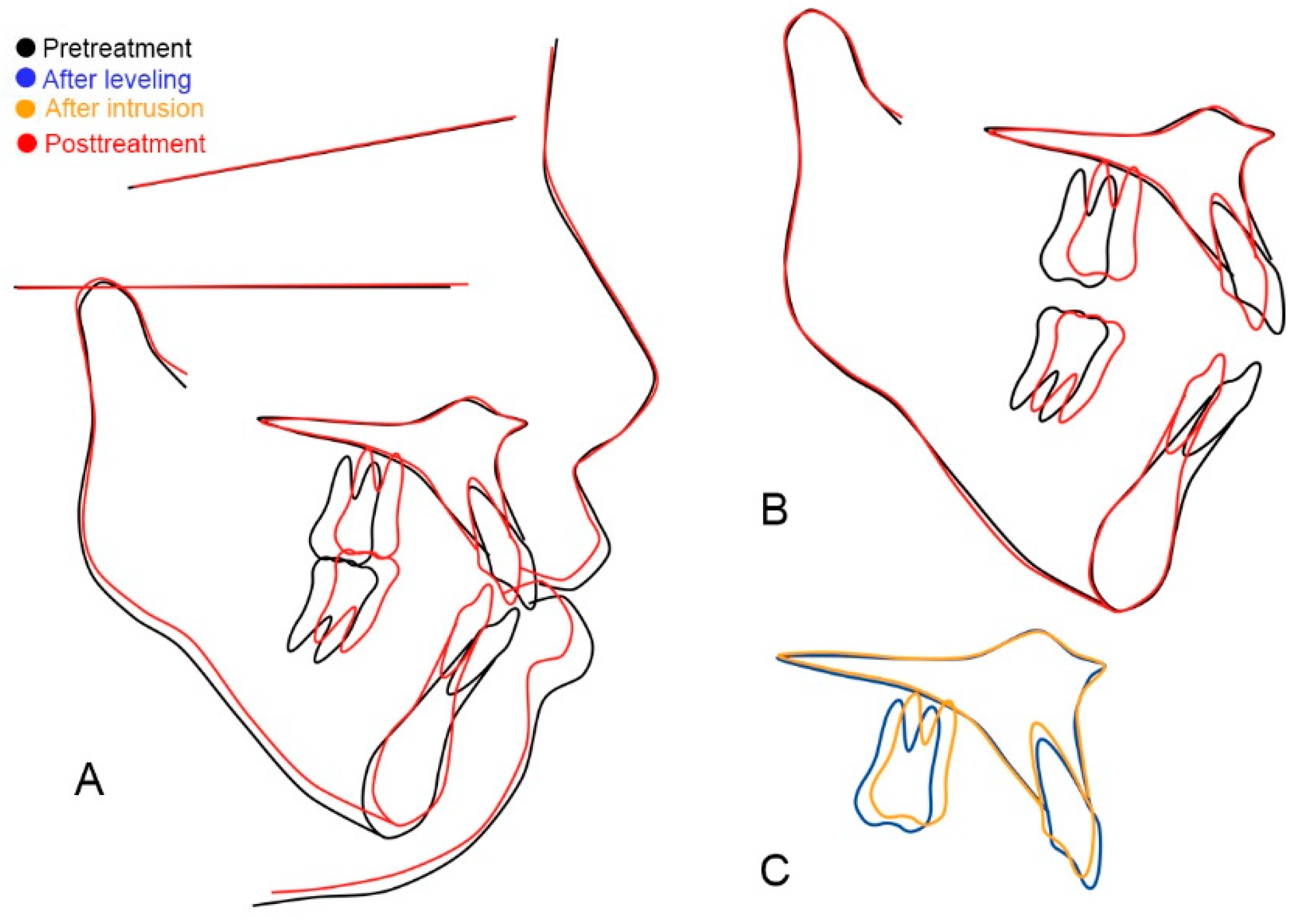 Applsci 13 05464 g011