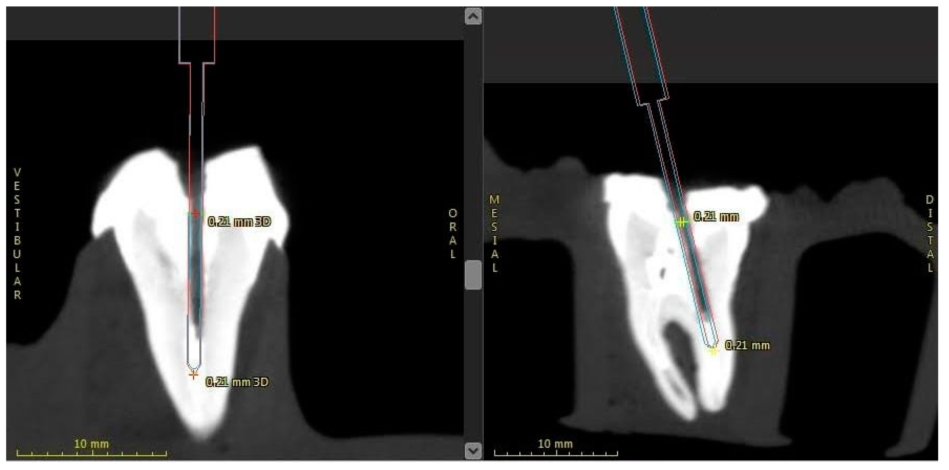 Applsci 13 05516 g004 Applsci 13 05516 g004