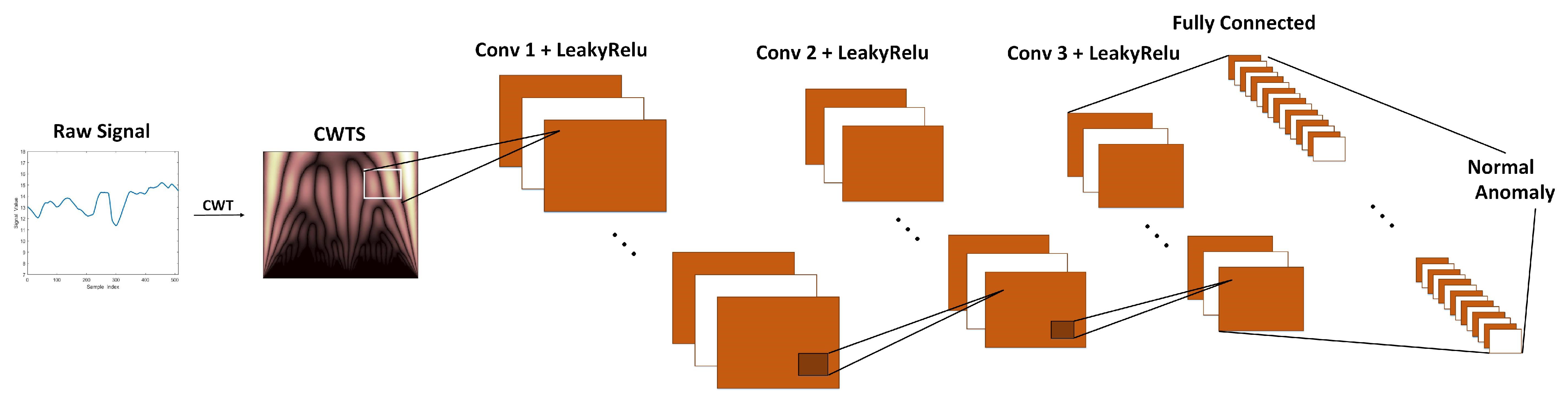 Anomaly Detection for Automated Vehicles Integrating Continuous Wavelet ...