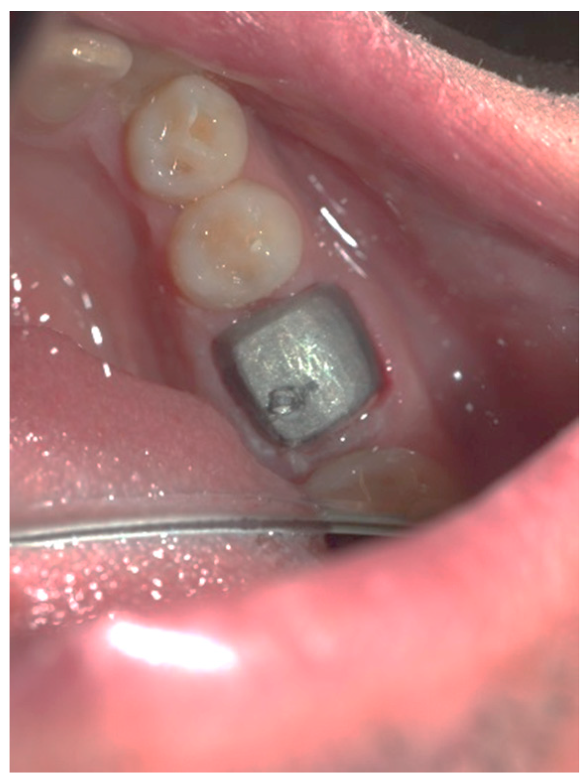 Applsci 13 05527 g006