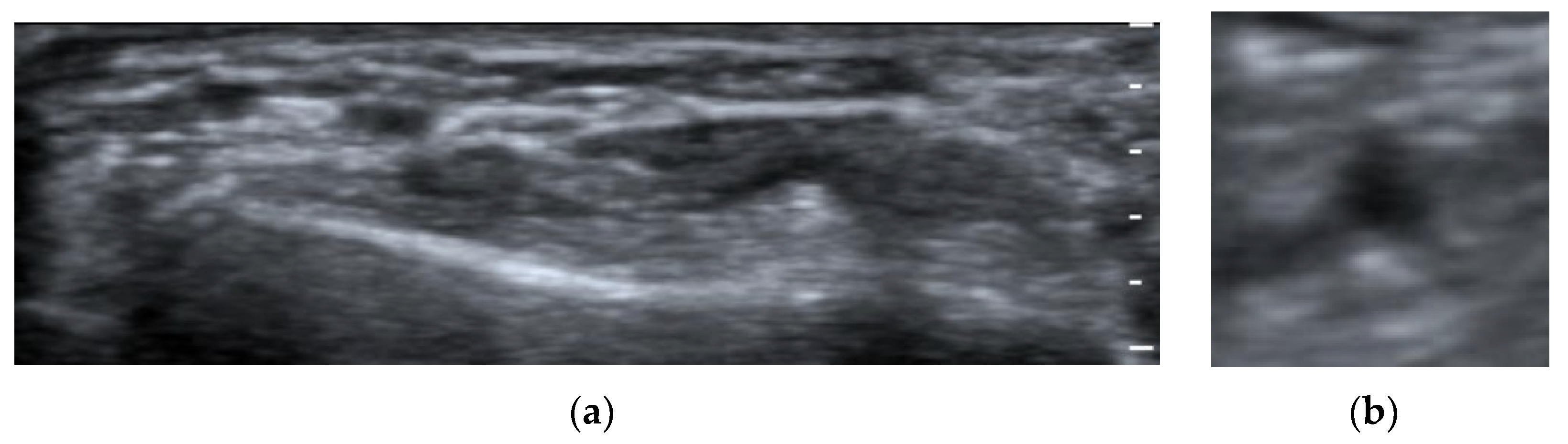 Applsci 13 05664 g011