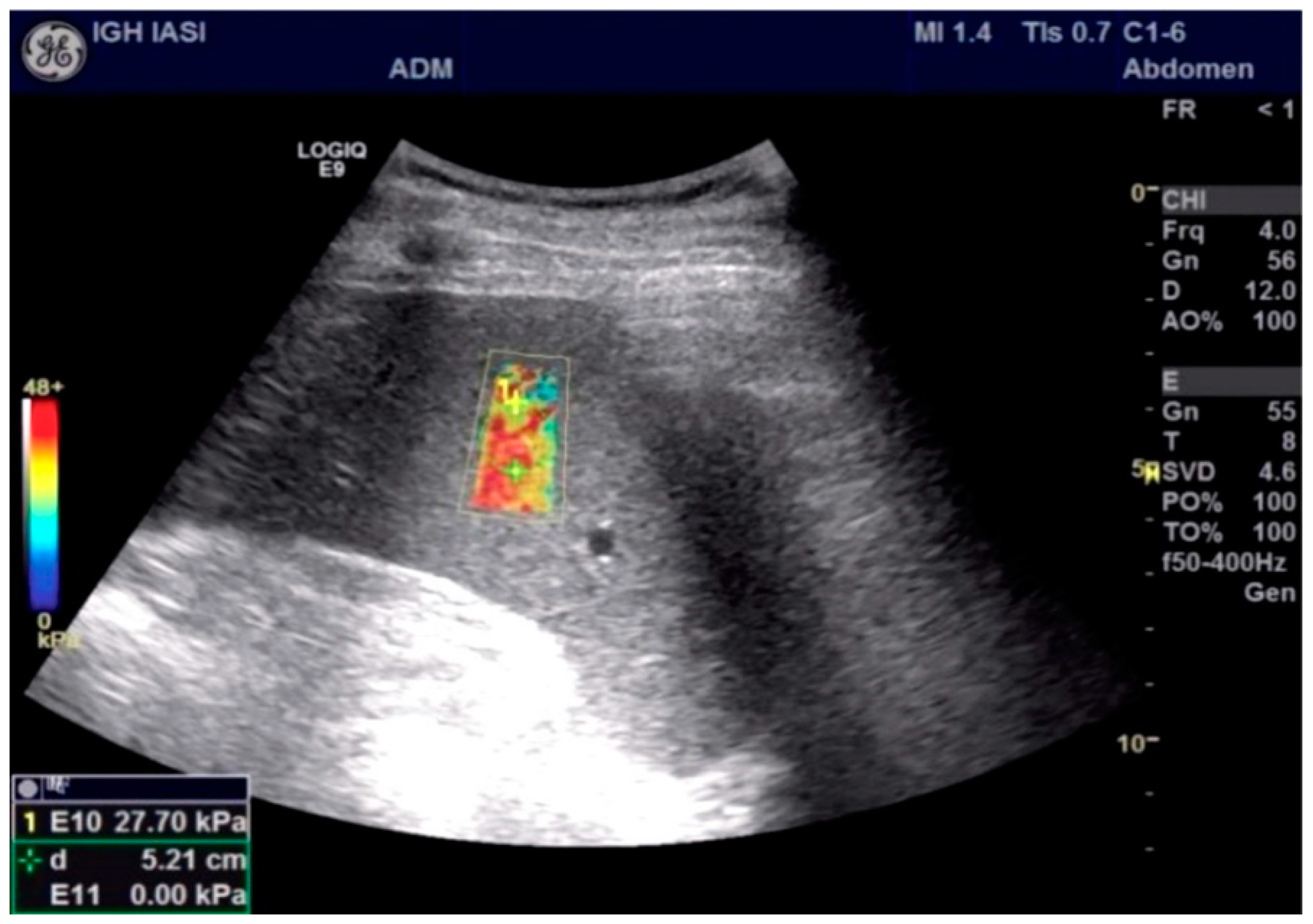 Applsci 13 05764 g001