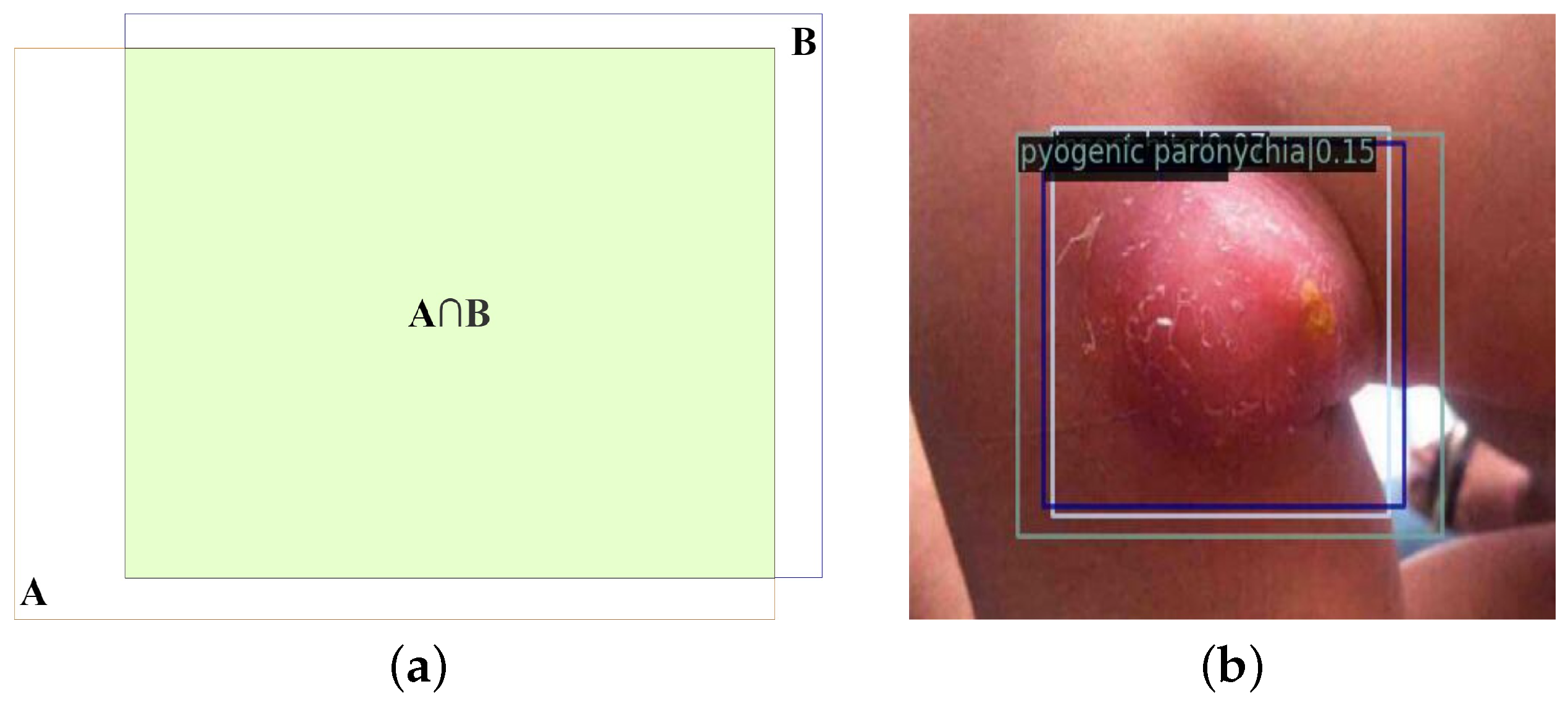 Applsci 13 05958 g005