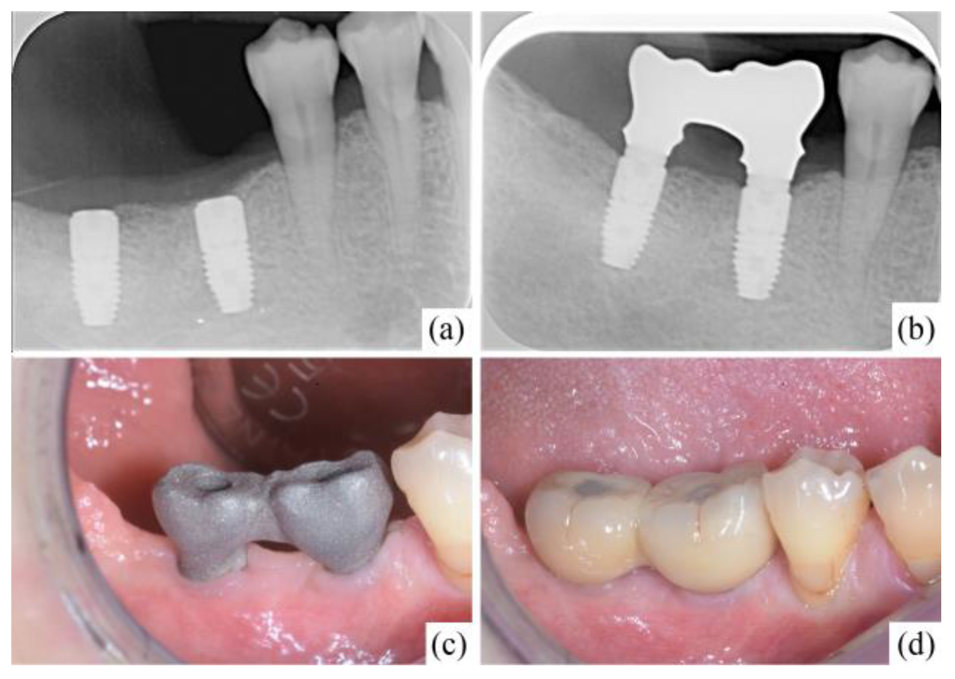 Applsci 13 06004 g008 Applsci 13 06004 g008