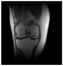 Applsci 13 06132 i011