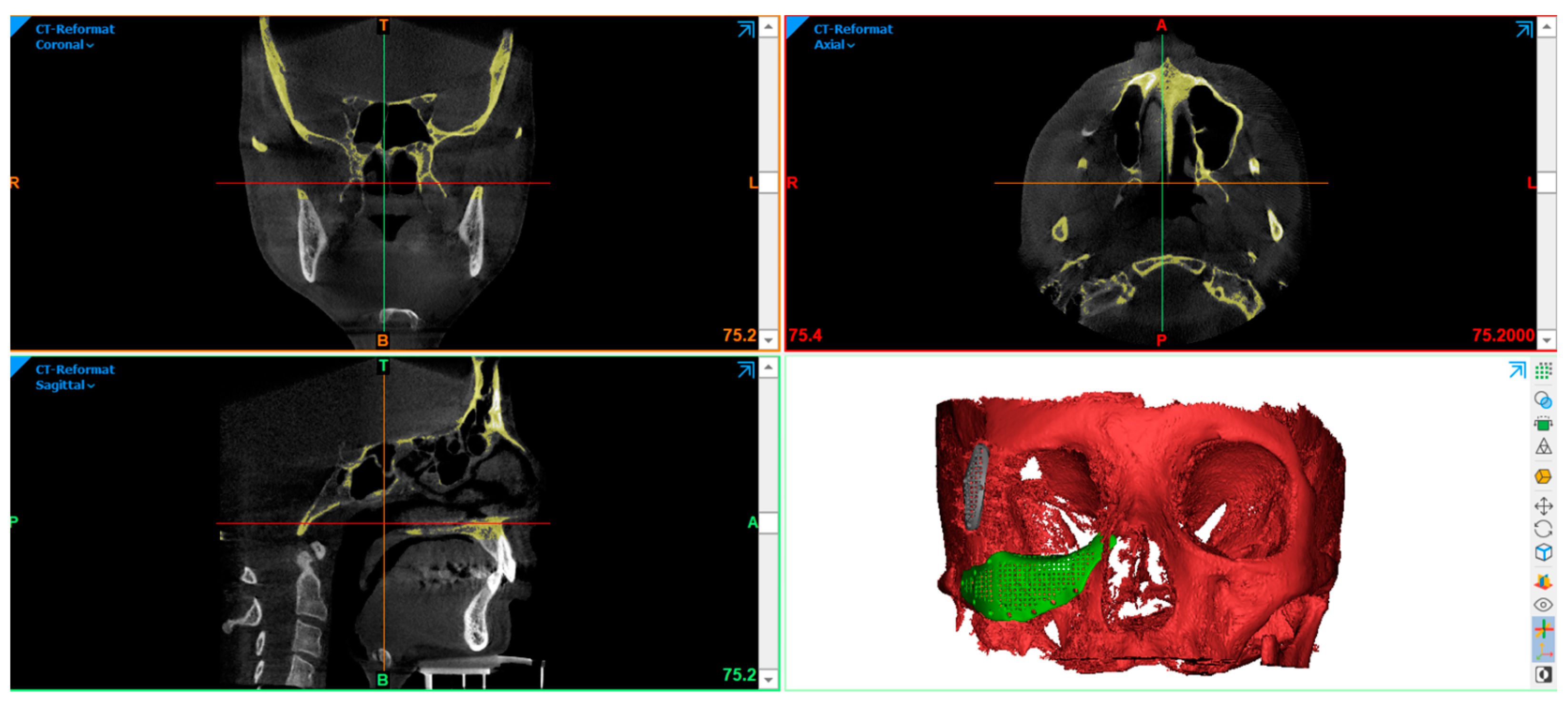 Applsci 13 06154 g002 Applsci 13 06154 g002