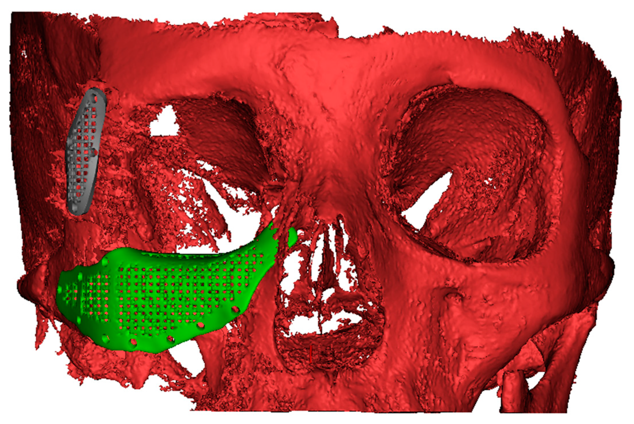 Applsci 13 06154 g003 Applsci 13 06154 g003