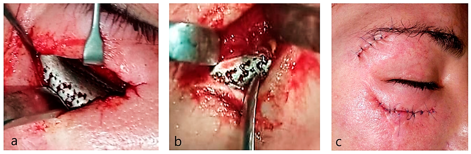 Applsci 13 06154 g004 Applsci 13 06154 g004