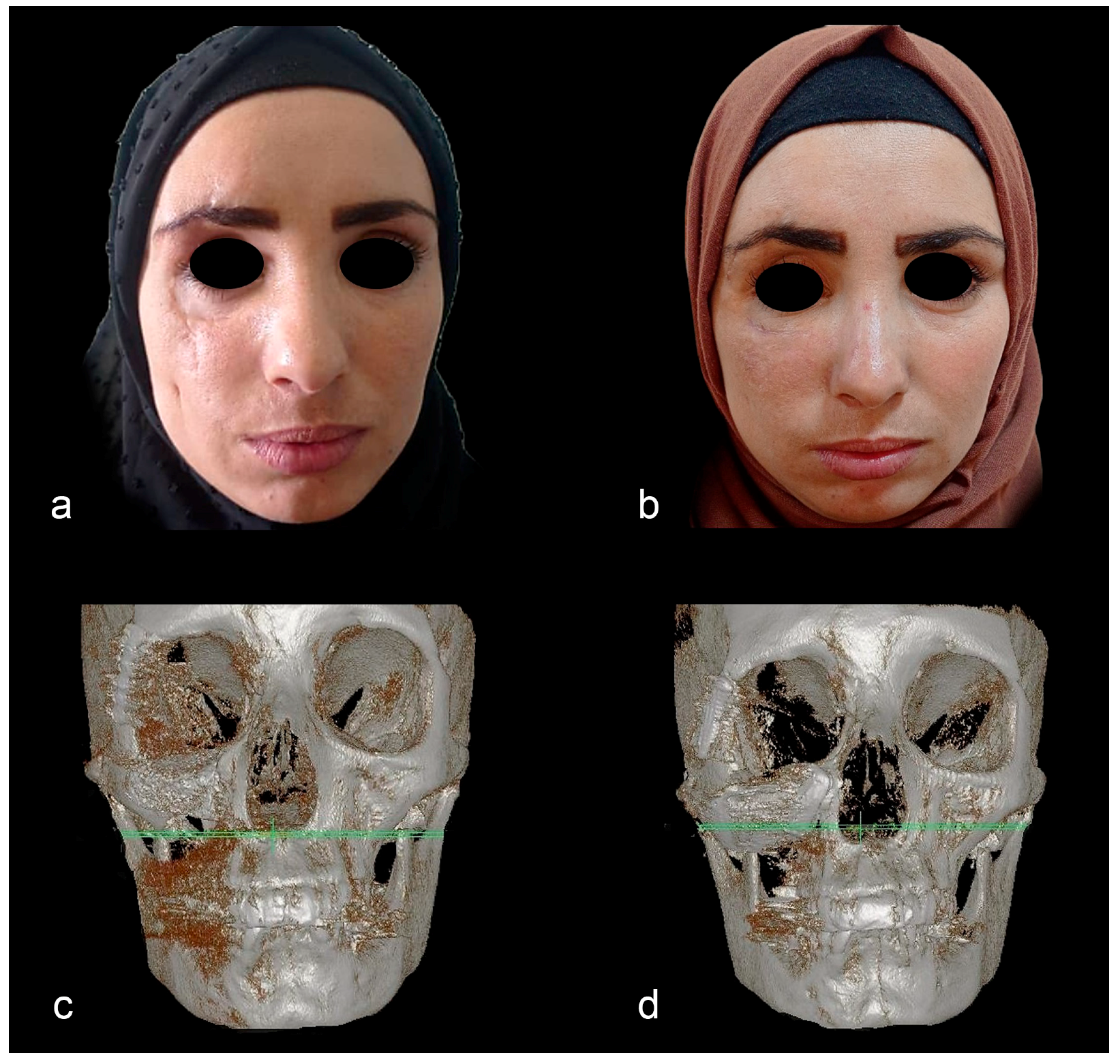 Applsci 13 06154 g006 Applsci 13 06154 g006
