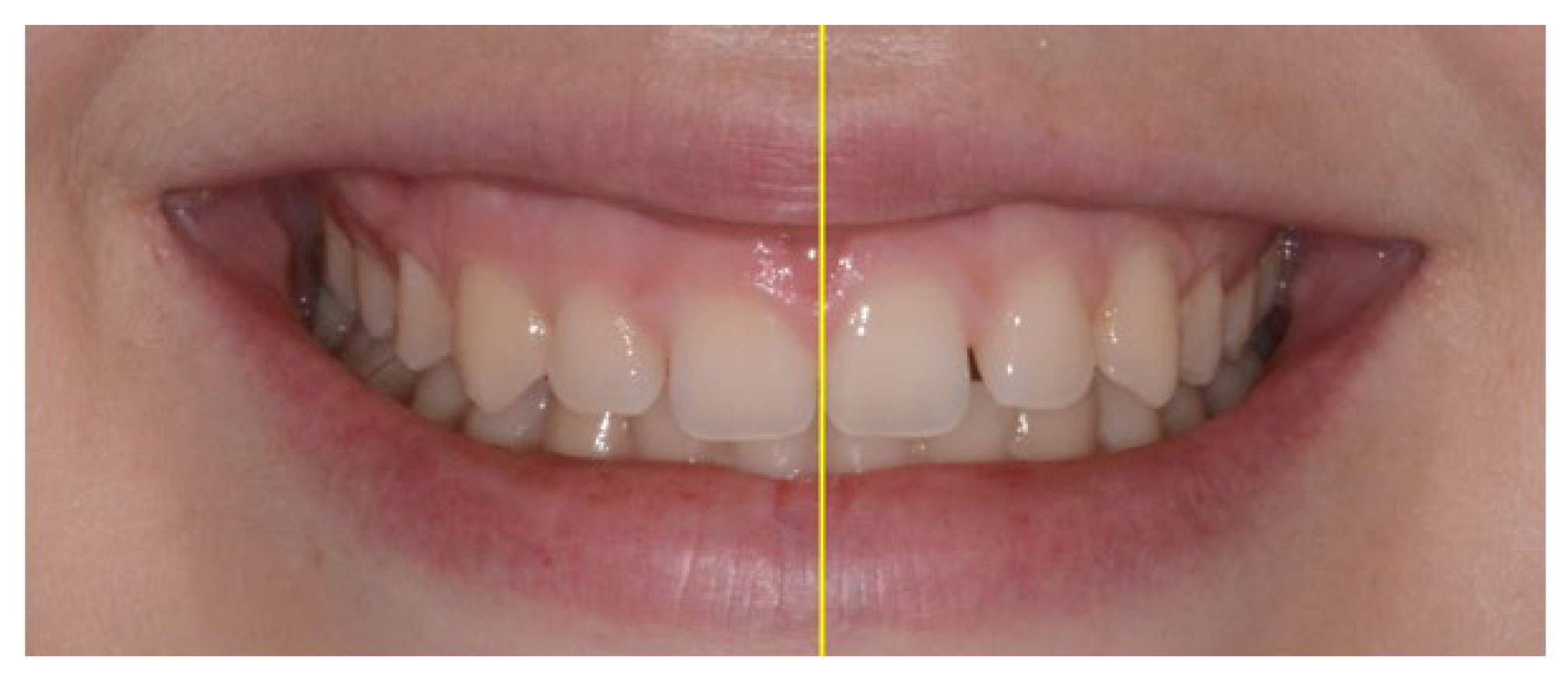 Applsci 13 06205 g005