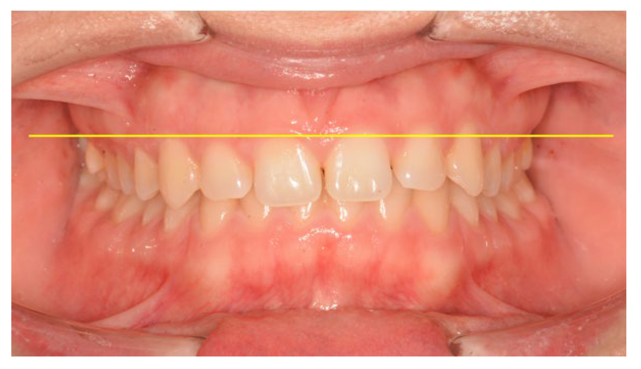 Applsci 13 06205 g006