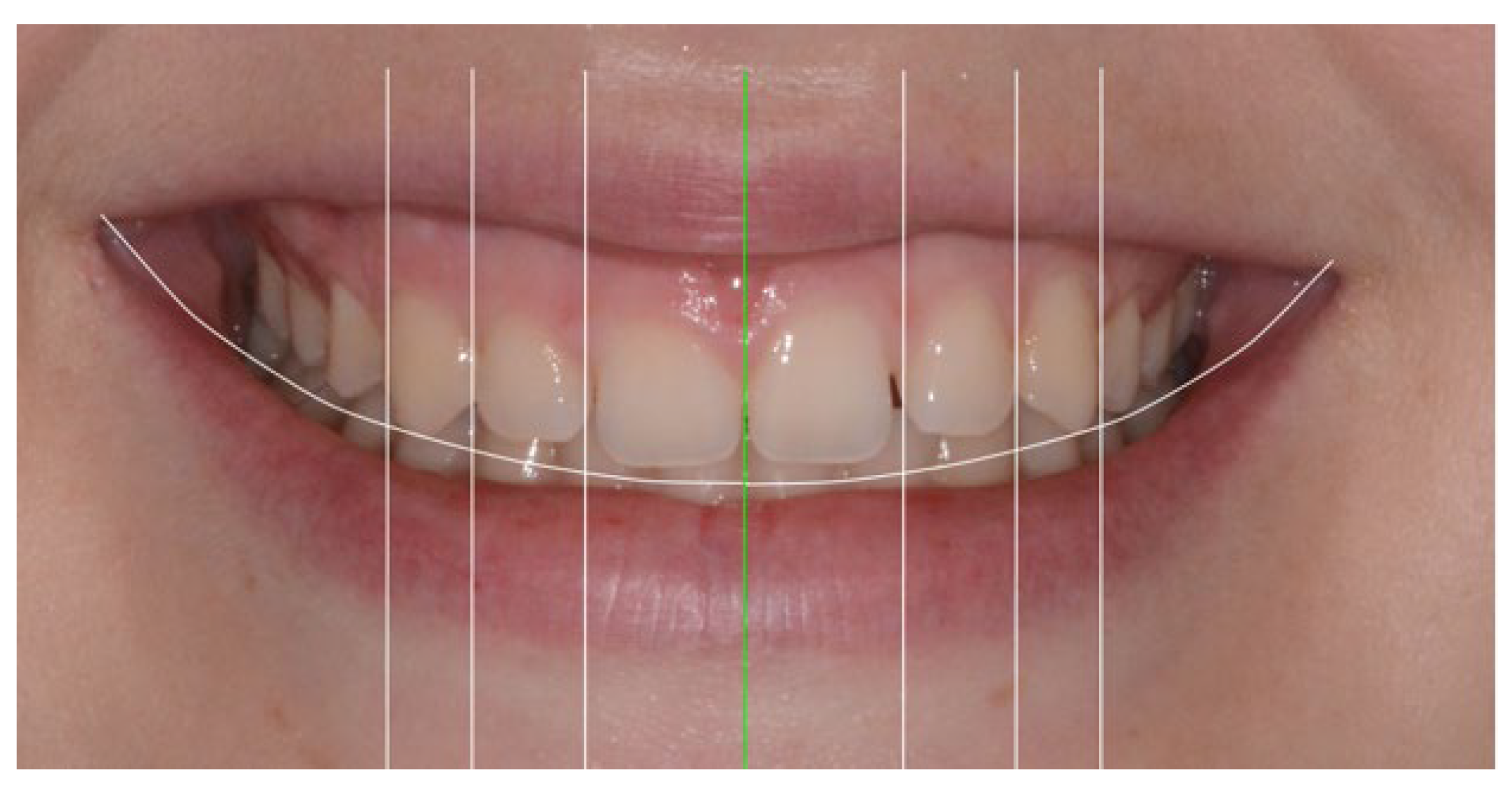 Applsci 13 06205 g007