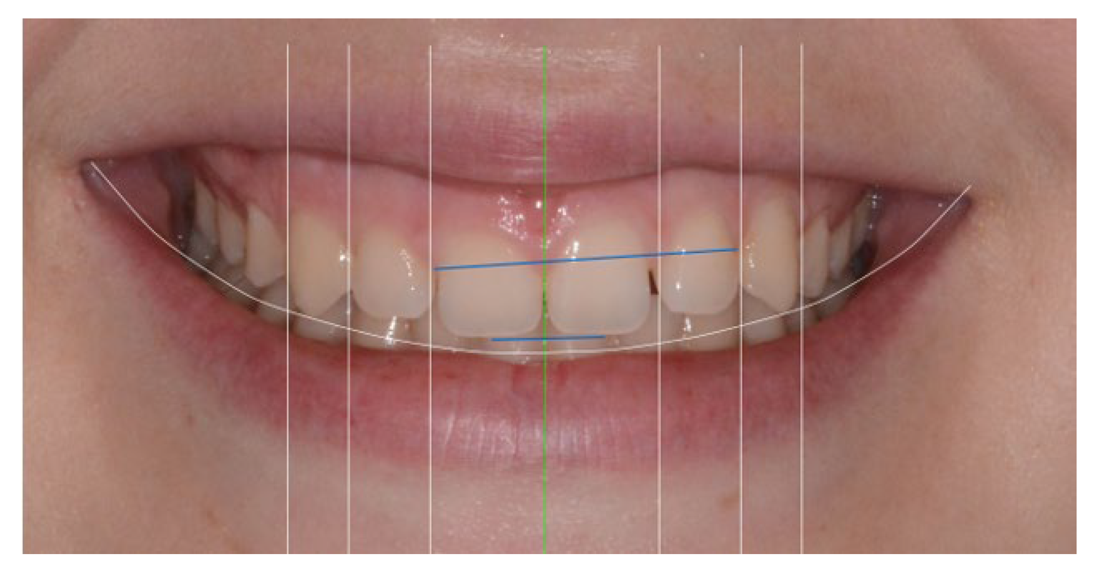 Applsci 13 06205 g008