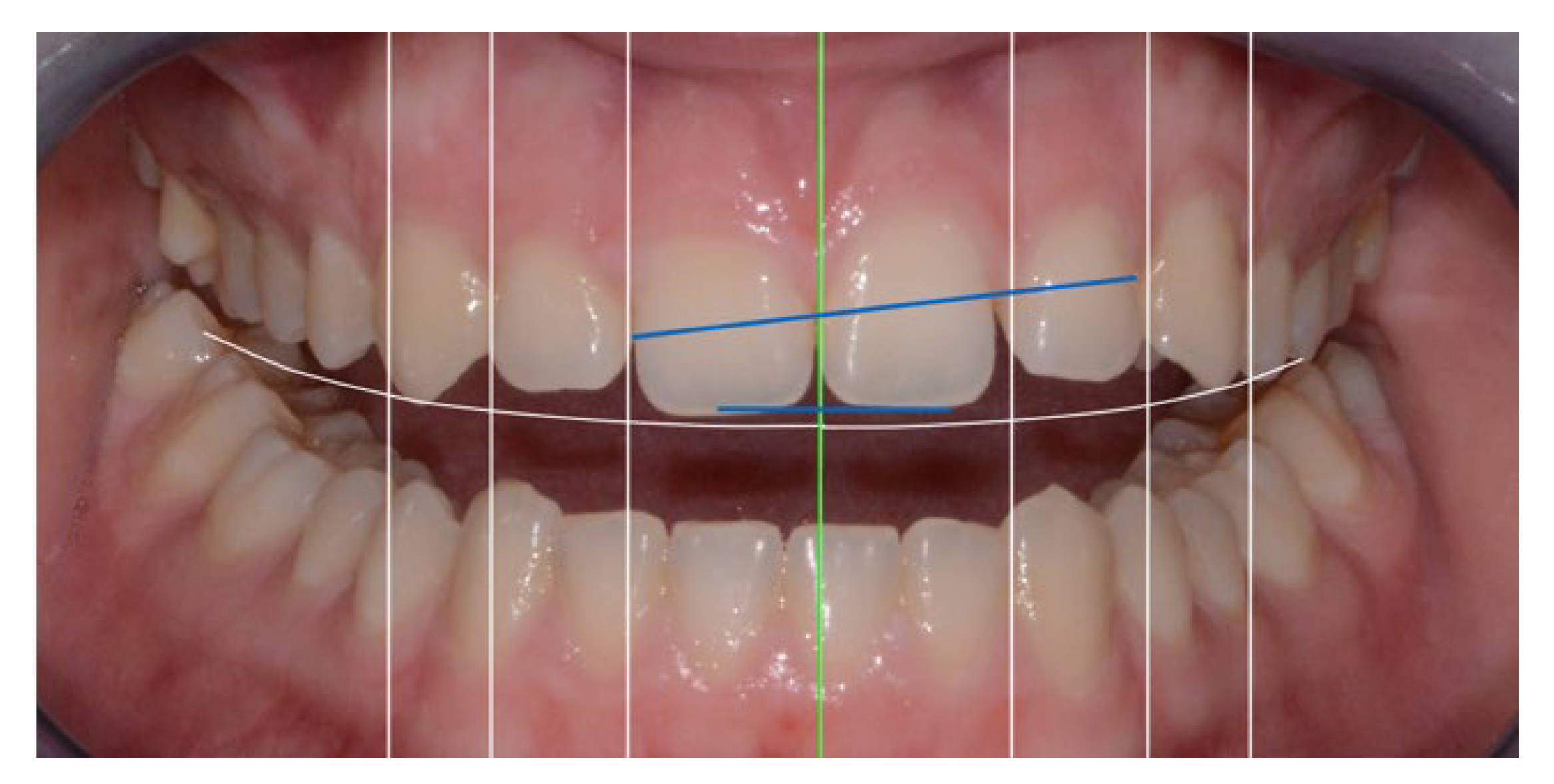 Applsci 13 06205 g009