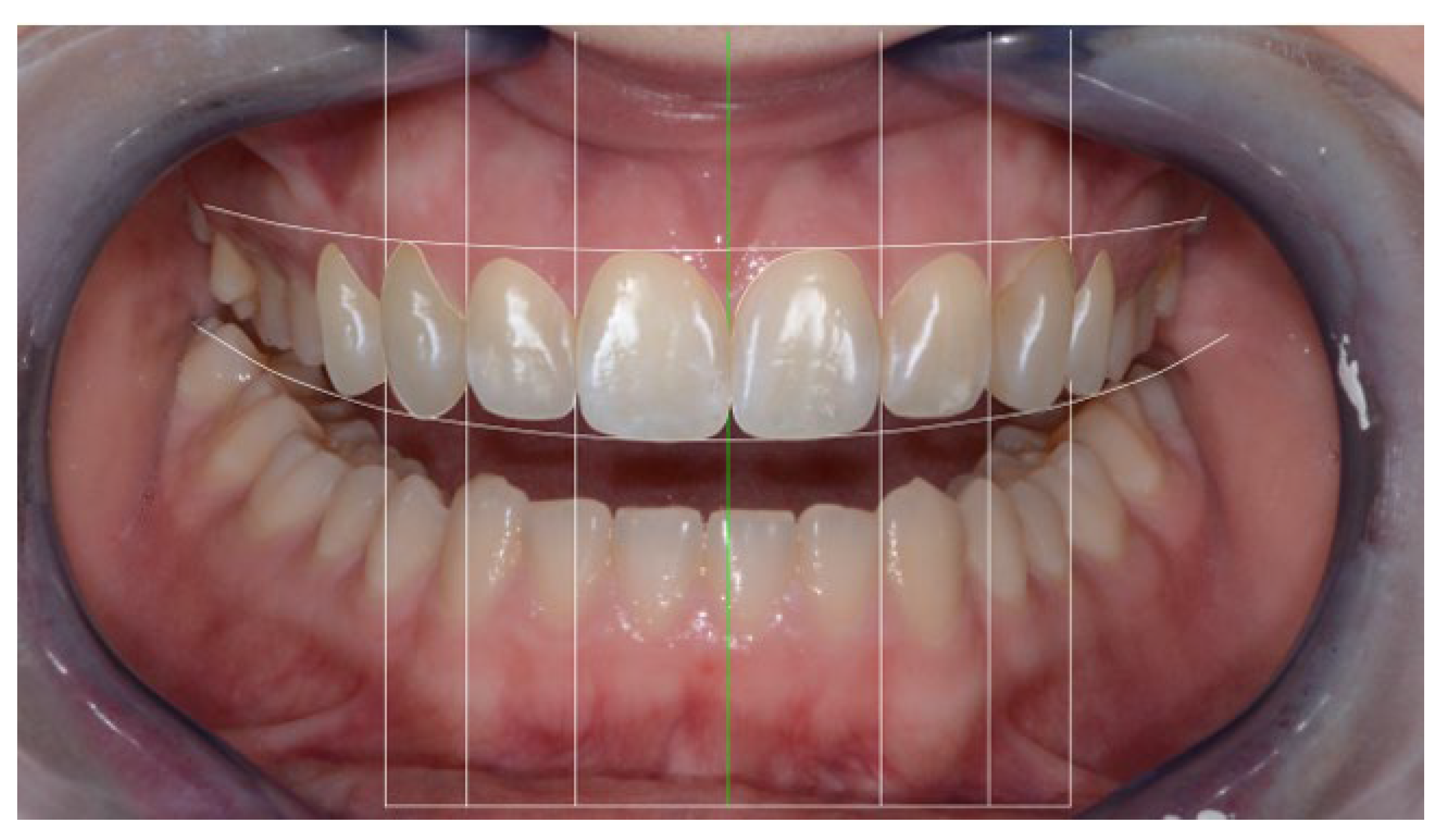 Applsci 13 06205 g011