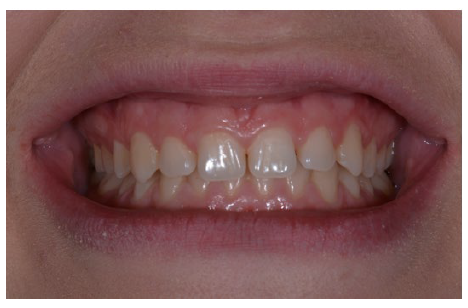 Applsci 13 06205 g017