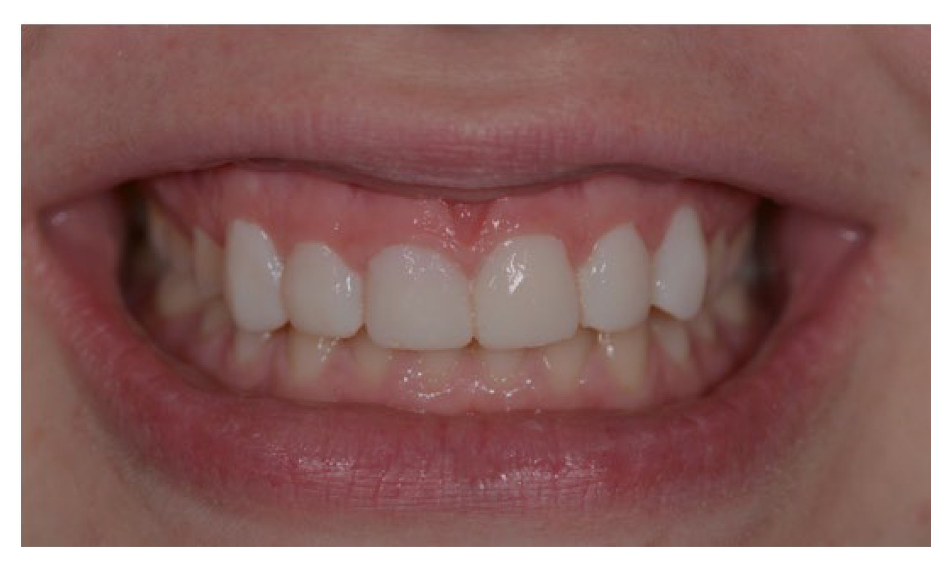 Applsci 13 06205 g018