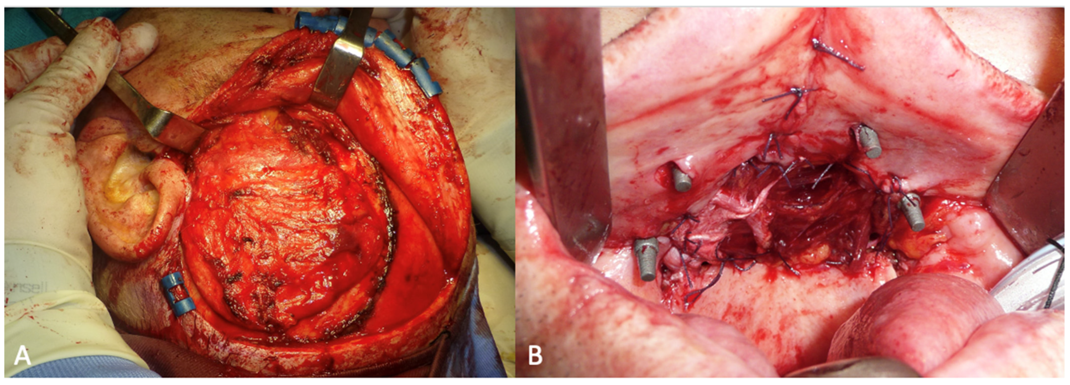 Applsci 13 06269 g005