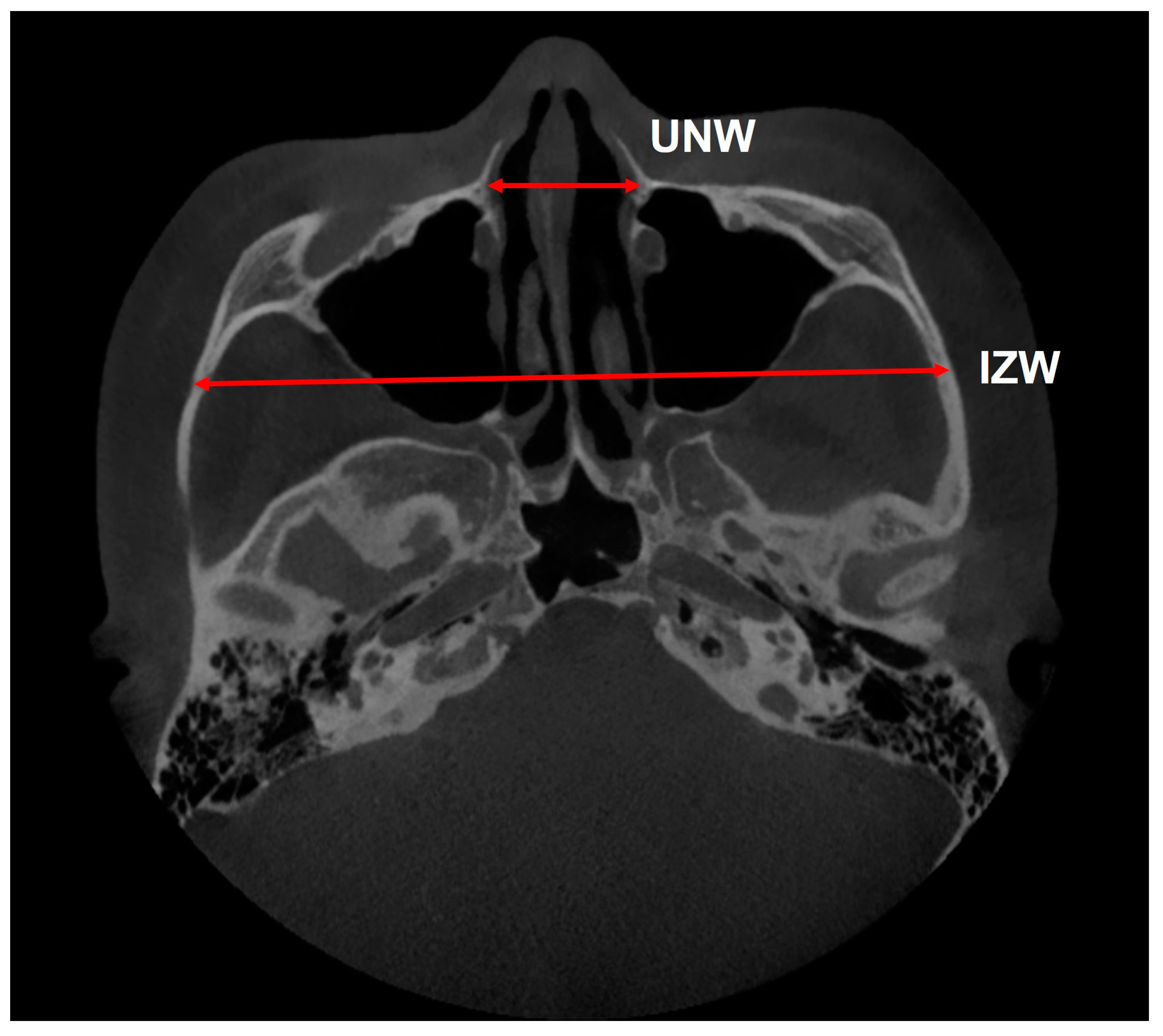 Applsci 13 06309 g004 Applsci 13 06309 g004