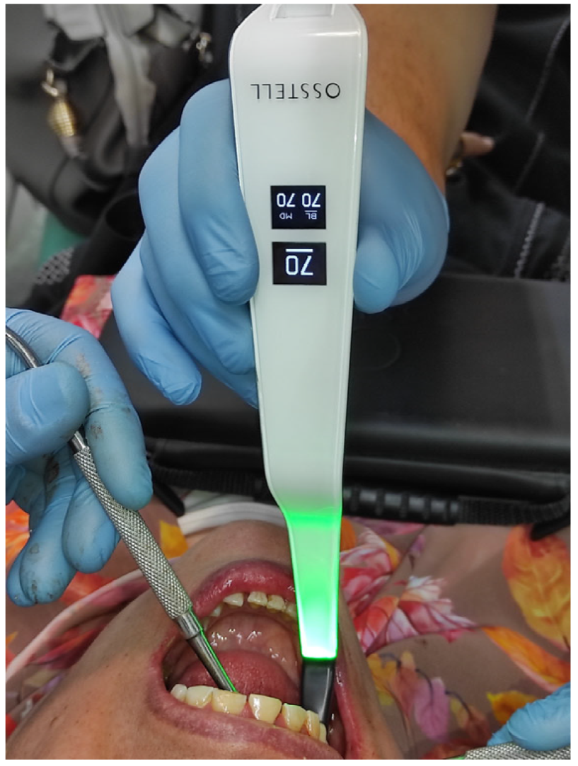 Applsci 13 06668 g004 Applsci 13 06668 g004