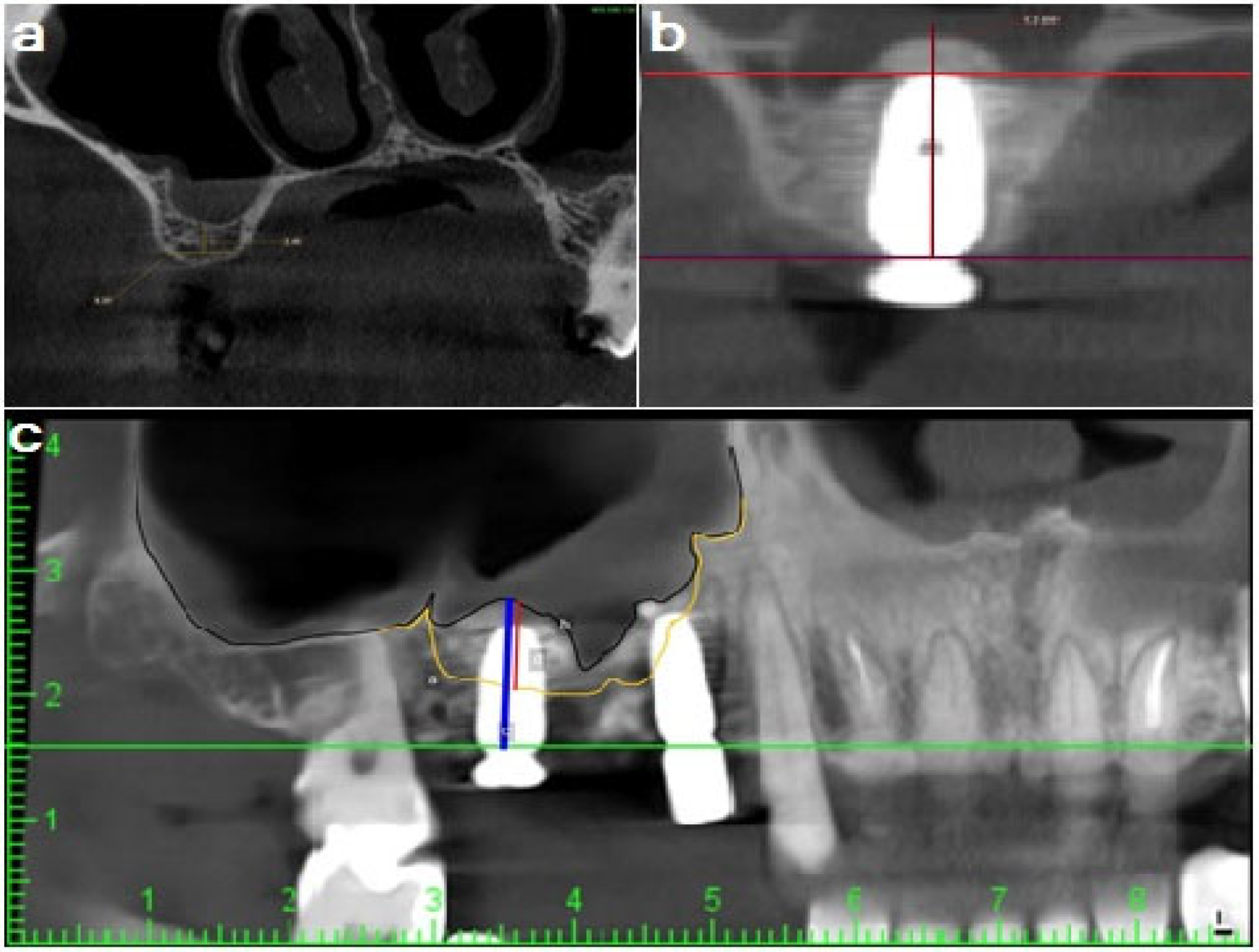 Applsci 13 06668 g006 Applsci 13 06668 g006