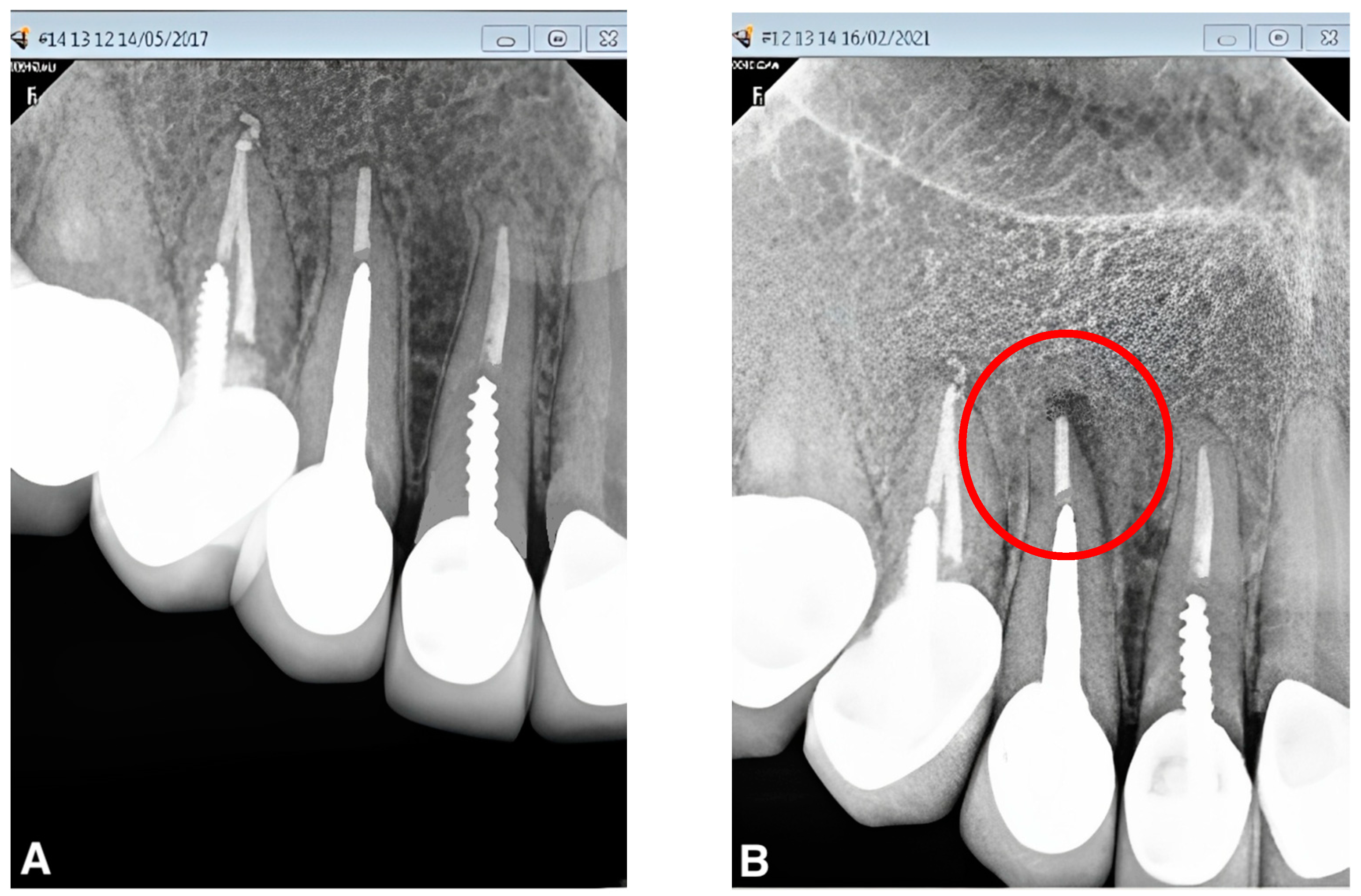 Applied Sciences Free FullText Effect of the Gap between Cemented