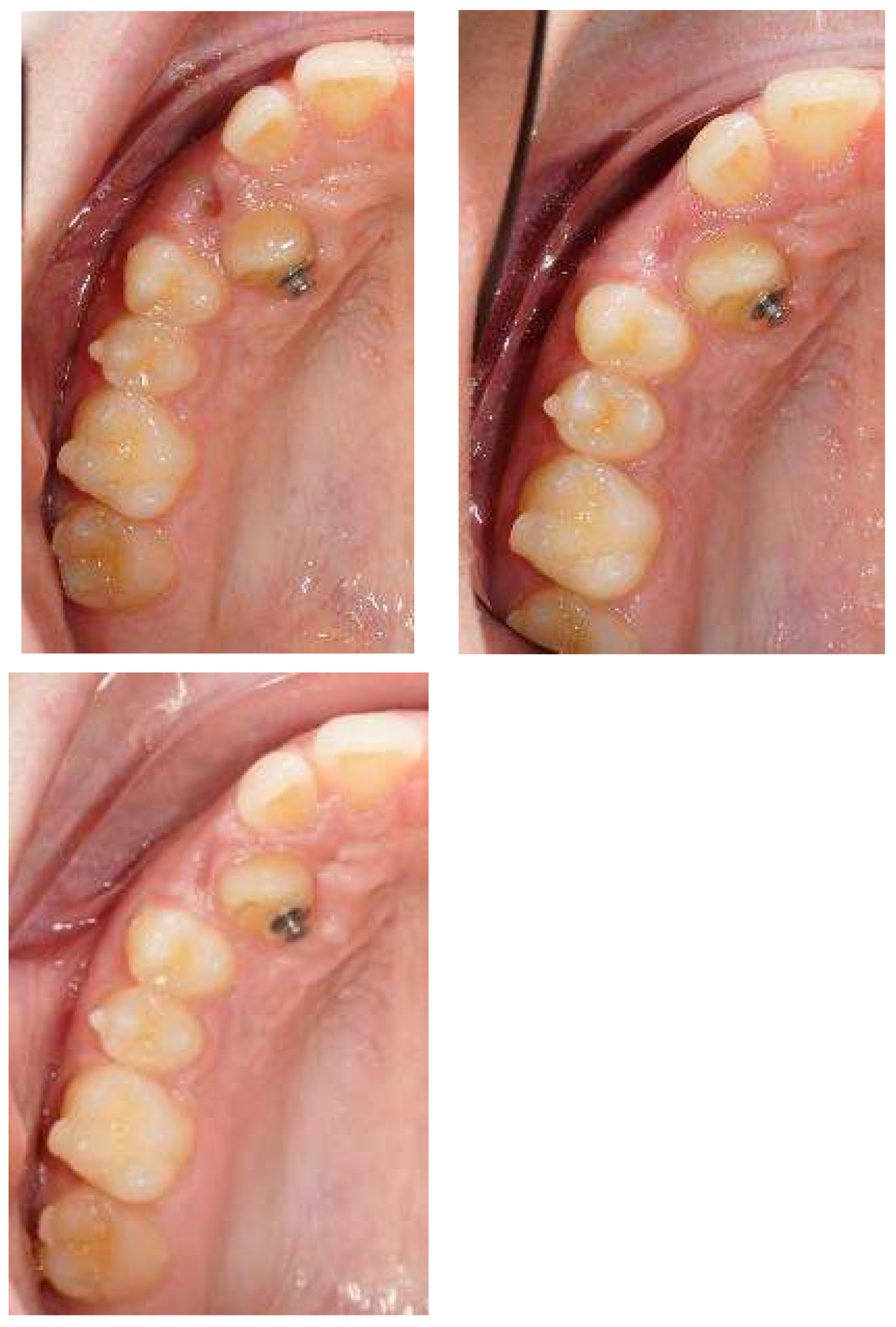 Applsci 13 06914 g006